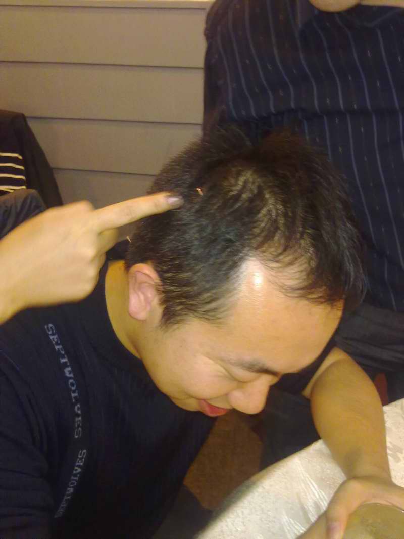 插秧针法！